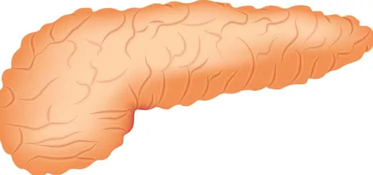 الإدارة الغذائية لالتهاب البنكرياس الحاد