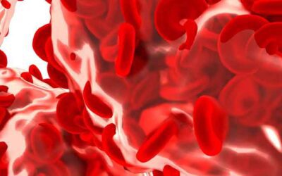 Sepsis and Its Complete Dietary Management Sepsis and Its Complete Dietary Management