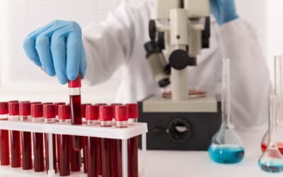 A1C Analyzer: Get Clear Insights Into Your Blood Sugar Levels A1C Analyzer